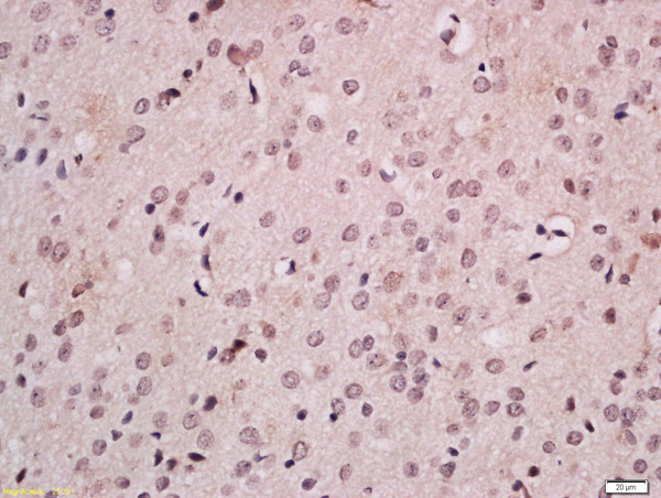 Formalin-fixed and paraffin embedded rat brain labeled with Anti-FOXB1 Polyclonal Antibody, Unconjugated (bs-11555R) at 1:200 followed by conjugation to the secondary antibody and DAB staining.