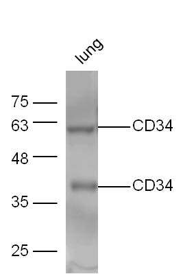 Mouse lung lysate probed with Anti-CD34 Polyclonal Antibody, Unconjugated (bs-0646R) at 1:300 overnight at 4˚C. Followed by conjugation to secondary antibody (bs-0295G-HRP) at 1:5000 for 90 min at 37˚C.