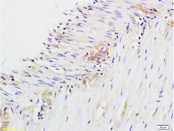 Formalin-fixed and paraffin embedded rat colitis labeled with Anti-CD28 Polyclonal Antibody, Unconjugated (bs-1297R) at 1:200 followed by conjugation to the secondary antibody and DAB staining.
