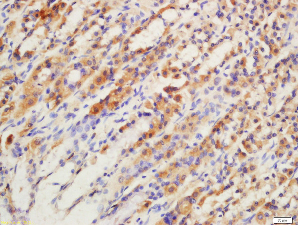 Formalin-fixed and paraffin embedded rat stomach labeled with Rabbit Anti-GPR15 Polyclonal Antibody, Unconjugated(bs-3699R) 1:200 followed by conjugation to the secondary antibody and DAB staining