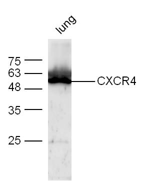 Mouse lung lysates probed with Anti-CXCR4 Polyclonal Antibody (bs-1011R) at 1:300 overnight at 4˚C. Followed by conjugation to secondary antibody (bs-0295G-HRP) at 1:5000 for 90 min at 37˚C.
