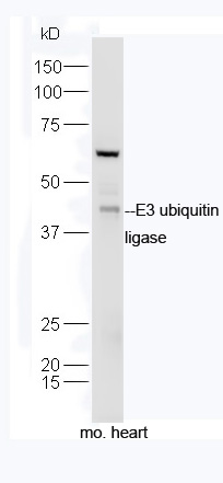 Mouse heart lysates probed with Rabbit Anti-E3 ubiquitin ligase Polyclonal Antibody, Unconjugated (bs-9663R) at 1:300 overnight at 4˚C. Followed by a conjugated secondary antibody (bs-0295G-HRP) at 1:5000 for 90 min at 37˚C.