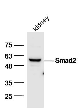 Mouse kidney lysates probed with Anti-Smad2 Polyclonal Antibody, Unconjugated (bs-0718R) at 1:300 overnight at 4˚C. Followed by conjugation to secondary antibody (bs-0295G-HRP) at 1:5000 for 90 min at 37˚C.