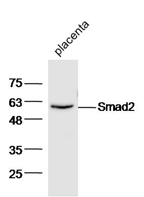 Mouse placenta lysates probed with Anti-Smad2 Polyclonal Antibody, Unconjugated (bs-0718R) at 1:300 overnight at 4˚C. Followed by conjugation to secondary antibody (bs-0295G-HRP) at 1:5000 for 90 min at 37˚C.