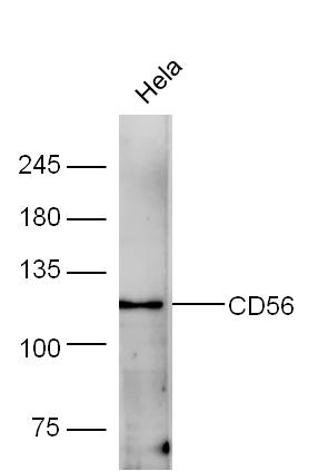 Human HeLa lysates probed with Rabbit Anti-CD56 Polyclonal Antibody, Unconjugated (bs-0736R) at 1:300 overnight at 4˚C. Followed by a conjugated secondary antibody (bs-0295G-HRP) at 1:5000 for 90 min at 37˚C.