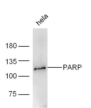 Human HeLa lysates probed with Rabbit Anti-PARP1 Polyclonal Antibody, Unconjugated (bs-2138R) at 1:300 overnight at 4˚C. Followed by a conjugated secondary antibody (bs-0295G-HRP) at 1:5000 for 90 min at 37˚C.
