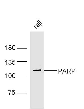 Human Raji lysates probed with Rabbit Anti-PARP1 Polyclonal Antibody, Unconjugated (bs-2138R) at 1:300 overnight at 4˚C. Followed by a conjugated secondary antibody (bs-0295G-HRP) at 1:5000 for 90 min at 37˚C.