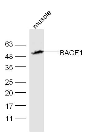 Mouse muscle lysates probed with Rabbit Anti-BACE1 Polyclonal Antibody, Unconjugated (bs-0164R) at 1:300 overnight at 4˚C. Followed by a conjugated secondary antibody (bs-0295G-HRP) at 1:5000 for 90 min at 37˚C.