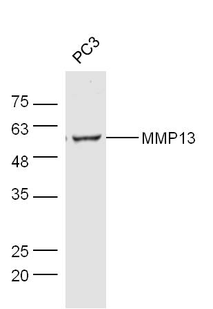 Human PC3 lysates probed with Rabbit Anti-MMP13 Polyclonal Antibody, Unconjugated (bs-0575R) at 1:300 overnight at 4˚C. Followed by a conjugated secondary antibody (bs-0295G-HRP) at 1:5000 for 90 min at 37˚C.