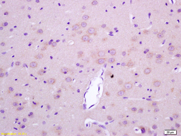 Formalin-fixed and paraffin embedded rat brain labeled with  Rabbit Anti LGI1\/ETL1 Polyclonal Antibody, Unconjugated (bs-6719R) at 1:200 followed by conjugation to the secondary antibody and DAB staining