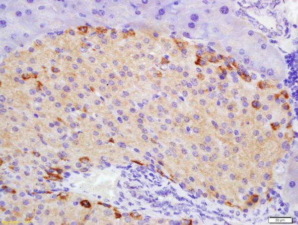 Formalin-fixed and paraffin embedded mouse pancreas labeled with Rabbit Anti-ATG1\/ULK1 Polyclonal Antibody, Unconjugated(bs-3602R) 1:200 followed by conjugation to the secondary antibody and DAB staining\\n