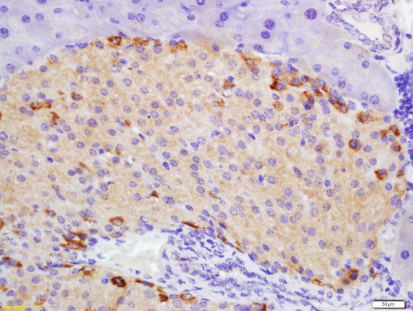 Formalin-fixed and paraffin embedded mouse pancreas labeled with Rabbit Anti-ATG1/ULK1 Polyclonal Antibody, Unconjugated(bs-3602R) 1:200 followed by conjugation to the secondary antibody and DAB staining\n