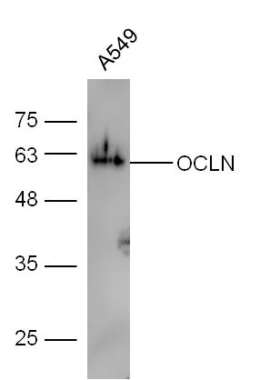 Human A549 lysates probed with Rabbit Anti-Occludin Polyclonal Antibody, Unconjugated (bs-1495R) at 1:300 overnight at 4˚C. Followed by a conjugated secondary antibody (bs-0295G-HRP) at 1:5000 for 90 min at 37˚C.
