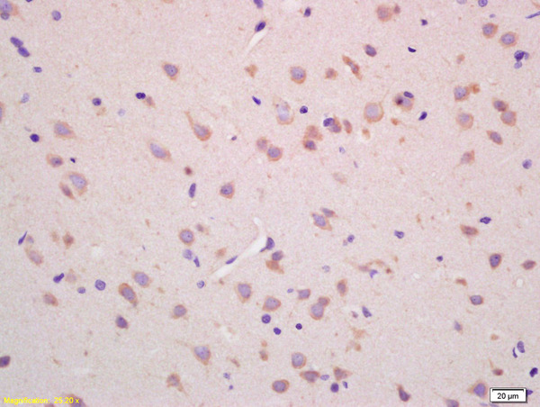 Formalin-fixed and paraffin embedded rat brain labeled with Rabbit Anti CHAC1 Polyclonal Antibody, Unconjugated (bs-6795R) at 1:200 followed by conjugation to the secondary antibody and DAB staining