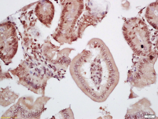 Formalin-fixed and paraffin embedded mouse intestine labeled with Rabbit Anti-TIF1 gamma Polyclonal Antibody, Unconjugated(bs-3582R) 1:200 followed by conjugation to the secondary antibody and DAB staining\n