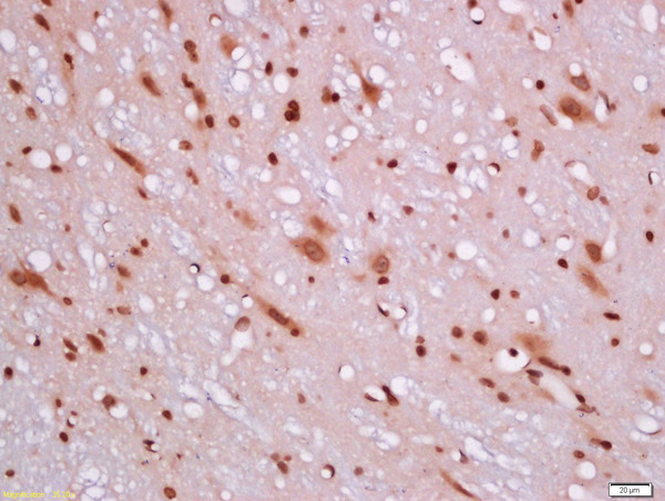 Formalin-fixed and paraffin embedded rat brain labeled with Rabbit Anti-BCL2L1 Polyclonal Antibody, Unconjugated(bs-1336R) 1:200 followed by conjugation to the secondary antibody and DAB staining\n