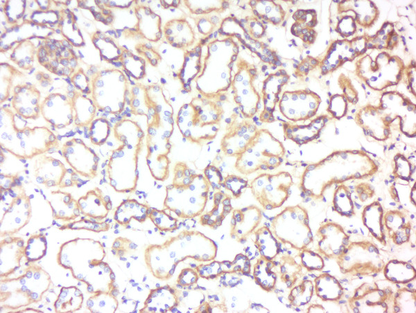 Formalin-fixed and paraffin embedded human kidney labeled with Rabbit Anti-5HT3B receptor Polyclonal Antibody, Unconjugated (bs-4289R) at 1:200 followed by conjugation to the secondary antibody and DAB staining