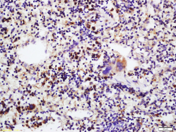 Formalin-fixed and paraffin mouse spleen labeled with Anti-IL-17C Polyclonal Antibody, Unconjugated (bs-2611R) at 1:200 followed by conjugation to the secondary antibody and DAB staining.