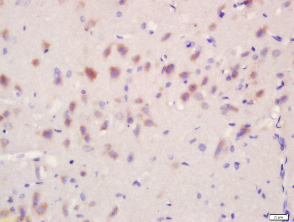 Formalin-fixed and paraffin embedded rat brain tissue labeled with Anti-Regucalcin/SMP30 Polyclonal Antibody, Unconjugated (bs-2665R) at 1:200 followed by conjugation to the secondary antibody and DAB stainin