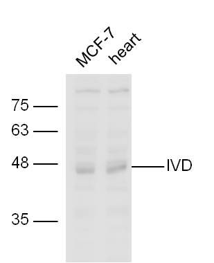 line1,MCF-7 lysates；line2,mouse heart lysate probed with Rabbit Anti-IVD Polyclonal Antibody, Unconjugated (bs-17189R) at 1:300 in 4˚C overnight. Followed by conjugation to secondary antibody (bs-0295G-HRP) at 1:5000 for 90min at 37˚C.