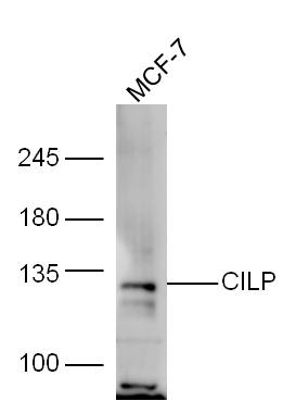 MCF-7 lysate probed with Rabbit Anti-CILP Polyclonal Antibody, Unconjugated (bs-13954R) at 1:300 in 4˚C overnight. Followed by conjugation to secondary antibody (bs-0295G-HRP) at 1:5000 for 90min at 37˚C. MCF-7 lysate probed with Rabbit Anti-CILP Polyclonal Antibody, Unconjugated (bs-13954R) at 1:300 in 4˚C overnight. Followed by conjugation to secondary antibody (bs-0295G-HRP) at 1:5000 for 90min at 37˚C.