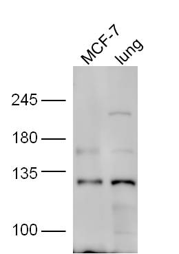 line1, MCF-7 lysate; line2,mouse lung lysate probed with Rabbit Anti-HNRPUL1 Polyclonal Antibody, Unconjugated (bs-17347R) at 1:300 in 4˚C overnight. Followed by conjugation to secondary antibody (bs-0295G-HRP) at 1:5000 for 90min at 37˚C.