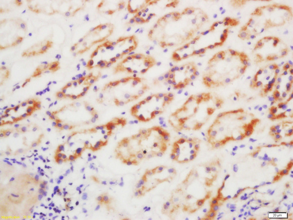 Formalin-fixed and paraffin embedded human kidney labeled with Anti-GST Polyclonal Antibody, Unconjugated (bs-2735R) at 1:200 followed by conjugation to the secondary antibody and DAB staining
