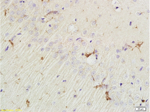 Formalin-fixed and paraffin embedded rat brain labeled with Rabbit Anti EphA7/Eph receptor A7 Polyclonal Antibody, Unconjugated (bs-7034R) at 1:200 followed by conjugation to the secondary antibody and DAB staining