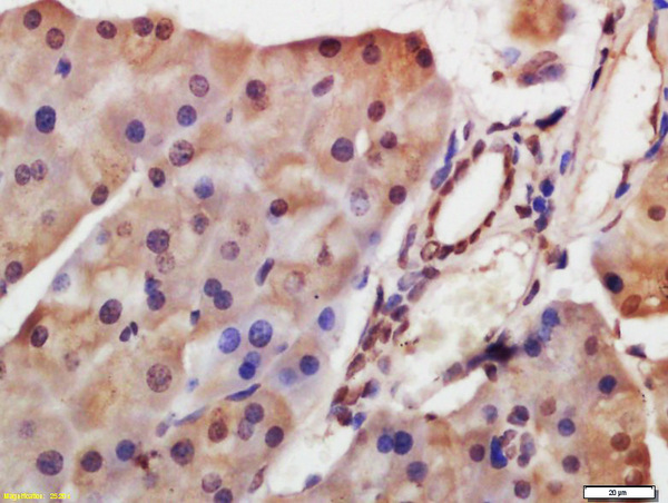 Formalin-fixed and paraffin embedded mouse pancreas labeled with Anti-HDAC8 Polyclonal Antibody, Unconjugated (bs-2891R) at 1:200 followed by conjugation to the secondary antibody and DAB staining.