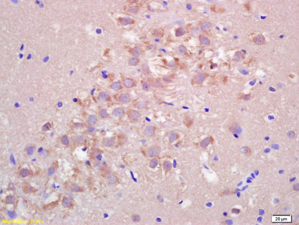 Formalin-fixed and paraffin embedded rat brain labeled with Rabbit Anti FIS1/TTC11 Polyclonal Antibody, Unconjugated (bs-7646R) at 1:200 followed by conjugation to the secondary antibody and DAB staining