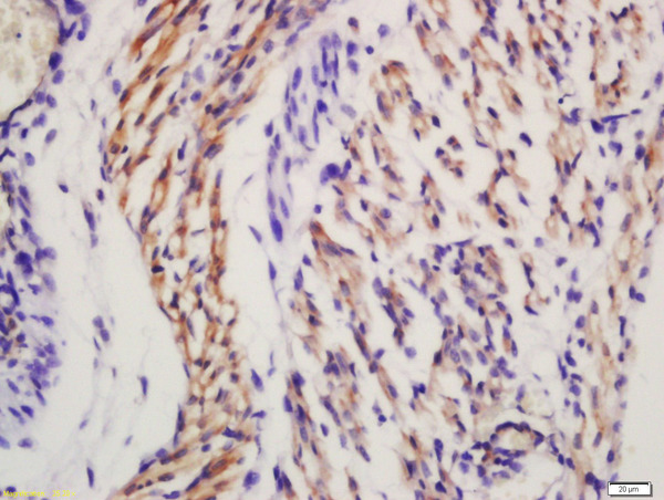 Formalin-fixed and paraffin embedded mouse embryo labeled with Anti-Frizzled 5/8 Polyclonal Antibody, Unconjugated (bs-2930R) at 1:200 followed by conjugation to the secondary antibody and DAB staining.