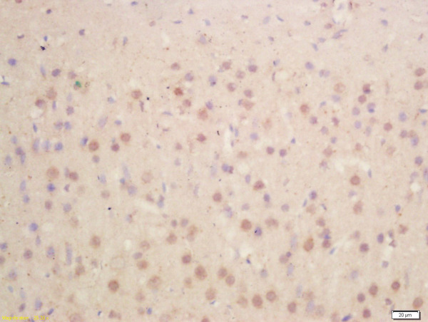 Formalin-fixed and paraffin embedded rat brain labeled with Anti-HES1 Polyclonal Antibody, Unconjugated (bs-2972R) at 1:200 followed by conjugation to the secondary antibody and DAB staining