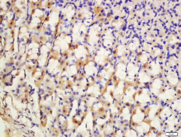 Formalin-fixed and paraffin embedded rat stomach labeled with Anti-SCN7A Polyclonal Antibody, Unconjugated (bs-12127R) at 1:200 followed by conjugation to the secondary antibody and DAB staining.