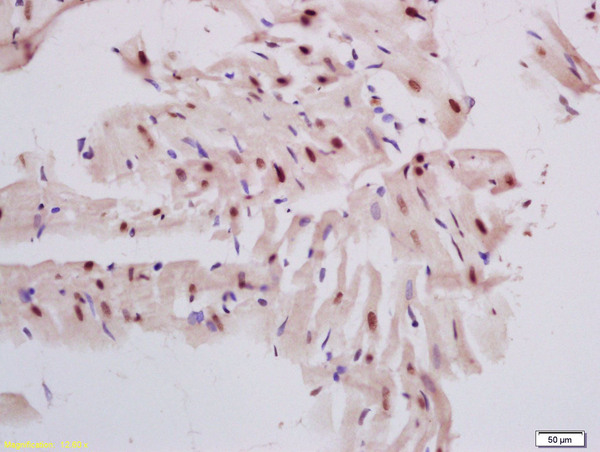 Formalin-fixed and paraffin embedded rat heart labeled with Rabbit Anti DNase gamma Polyclonal Antibody, Unconjugated (bs-7653R) at 1:200 followed by conjugation to the secondary antibody and DAB staining