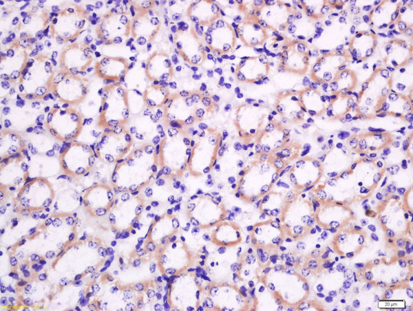 Formalin-fixed and paraffin embedded mouse kidney tissue labeled with Rabbit Anti-Nocturnin Polyclonal Antibody, Unconjugated (bs-11444R) at 1:200 followed by conjugation to the secondary antibody and DAB staining