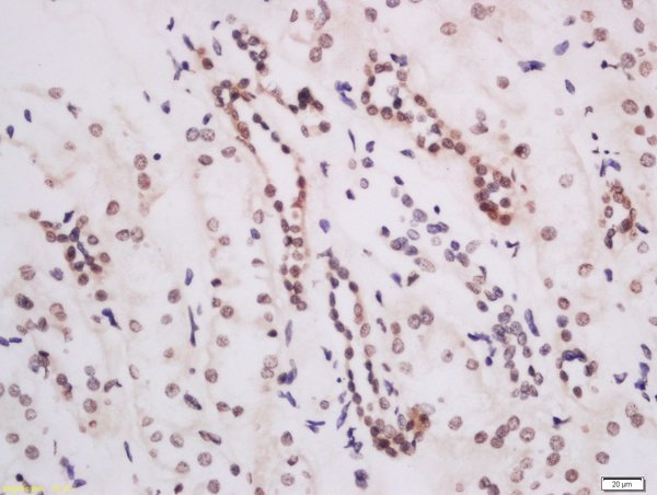 Formalin-fixed and paraffin embedded human kidney labeled with Anti-DOT1L Polyclonal Antibody, Unconjugated (bs-16797R) at 1:200 followed by conjugation to the secondary antibody and DAB staining.