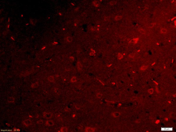 Formalin-fixed and paraffin embedded rat brain tissue labeled with Rabbit Anti-Netrin G1 Ligand Polyclonal Antibody, Unconjugated (bs-6710R) at 1:200 followed by Goat Anti-Rabbit IgG, Cy3 conjugated (bs-0295G-Cy3) used at 1:200 dilution for 40 minutes at 37°C.