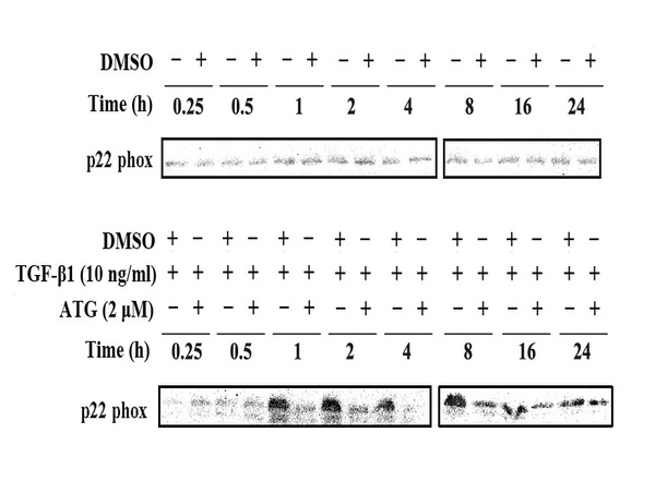 This image was generously provided by Ao Li, MD from Chongqing University of Technology. Serum-starved HK-2 cells were pretreated with DMSO (vehicle) or ATG (2 μM) for 4 h, and then incubated with 10 ng/ml TGF-β1 for 0.25–24 hr This image was generously provided by Ao Li, MD from Chongqing University of Technology. Serum-starved HK-2 cells were pretreated with DMSO (vehicle) or ATG (2 μM) for 4 h, and then incubated with 10 ng/ml TGF-β1 for 0.25–24 hr
