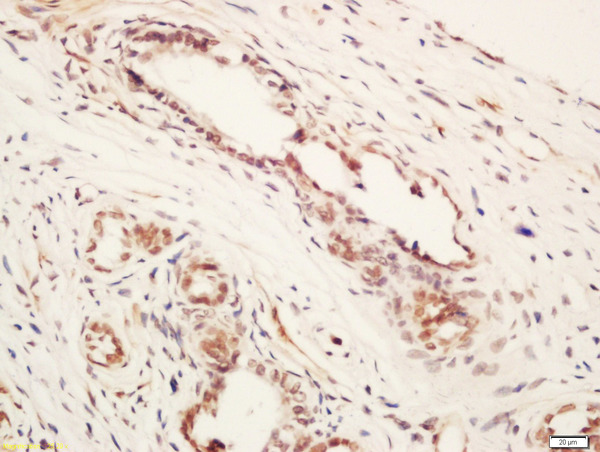 Formalin-fixed and paraffin embedded mouse ovary labeled with Rabbit Anti-ARMCX1 Polyclonal Antibody, Unconjugated (bs-5988R) at 1:200 followed by conjugation to the secondary antibody and DAB staining\n