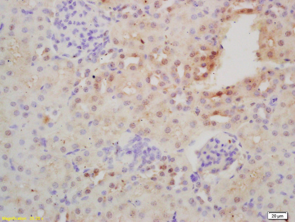 Formalin-fixed and paraffin embedded mouse kidney labeled with Rabbit Anti-NFKB Polyclonal Antibody, Unconjugated (bs-10037R) at 1:200 followed by conjugation to the secondary antibody and DAB staining\\n
