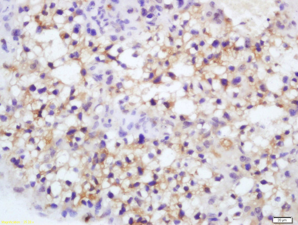 Formalin-fixed and paraffin embedded mouse placenta labeled with Rabbit Anti-Endothelial Lipase Polyclonal Antibody, Unconjugated (bs-10188R) at 1:200 followed by conjugation to the secondary antibody and DAB staining\n