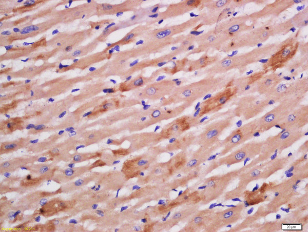 Formalin-fixed and paraffin embedded rat heart labeled with Rabbit Anti-Sarcomeric Alpha Actinin Polyclonal Antibody, Unconjugated (bs-10367R) at 1:200 followed by conjugation to the secondary antibody and DAB staining\n