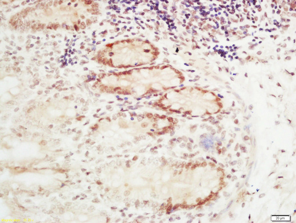 Formalin-fixed and paraffin embedded mouse intestine labeled with Rabbit Anti-RFC2 Polyclonal Antibody, Unconjugated (bs-11305R) at 1:200 followed by conjugation to the secondary antibody and DAB staining\n