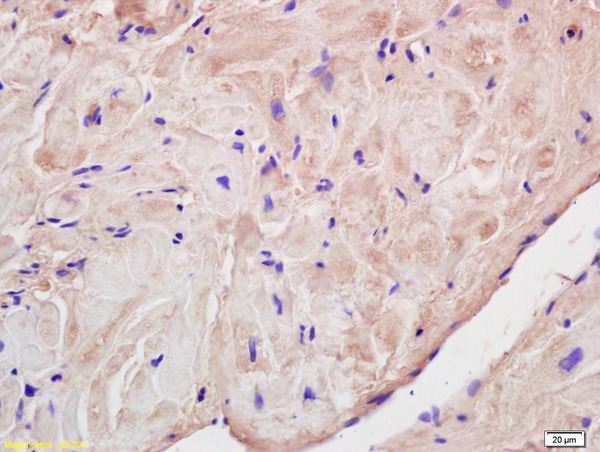 Formalin-fixed and paraffin embedded rat cardiac muscle labeled with Rabbit Anti Corin Polyclonal Antibody, Unconjugated (bs-7685R) at 1:200 followed by conjugation to the secondary antibody and DAB staining