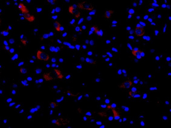 This image was generously provided by Adib Zendedel, PhD from RWTH Aachen University. Formalin-fixed and paraffin embedded rat spinal cord tissue labeled with Rabbit Anti-Cryopyrin Polyclonal Antibody, Unconjugated (bs-10021R) at 1:300 followed by conjugation to a secondary antibody