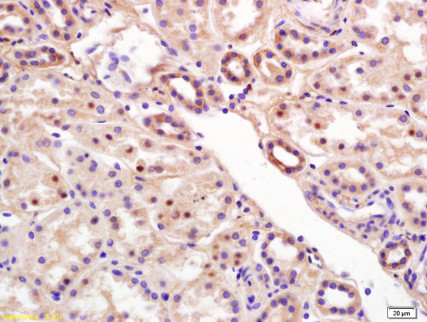 Formalin-fixed and paraffin embedded human kidney labeled with Rabbit Anti RCL/c Myc responsive Polyclonal Antibody, Unconjugated (bs-7827R) at 1:200 followed by conjugation to the secondary antibody and DAB staining