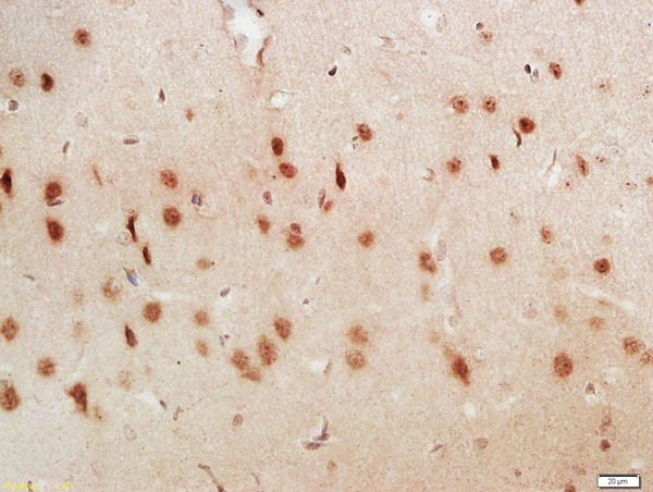 Formalin-fixed and paraffin embedded rat brain labeled with Anti-LUC7L3 Polyclonal Antibody, Unconjugated (bs-14067R) at 1:200 followed by conjugation to the secondary antibody and DAB staining Formalin-fixed and paraffin embedded rat brain labeled with Anti-LUC7L3 Polyclonal Antibody, Unconjugated (bs-14067R) at 1:200 followed by conjugation to the secondary antibody and DAB staining