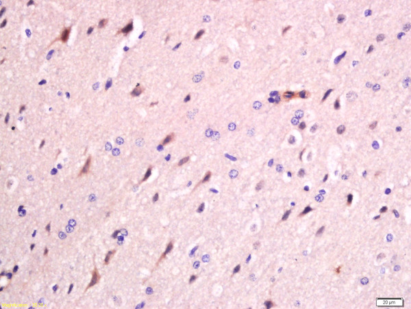 Formalin-fixed and paraffin embedded rat brain labeled with Anti-FAM134B Polyclonal Antibody, Unconjugated (bs-13136R) at 1:200 followed by conjugation to the secondary antibody and DAB staining
