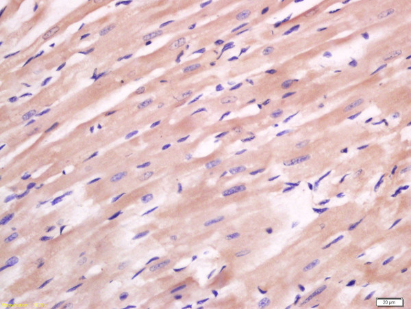 Formalin-fixed and paraffin embedded rat heart labeled with Anti-FAM134B Polyclonal Antibody, Unconjugated (bs-13136R) at 1:200 followed by conjugation to the secondary antibody and DAB staining