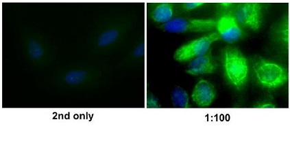 Image provided by One World Lab validation program. U138 cells were stained with bs-0756R Rabbit Anti-Vimentin Polyclonal Antibody at 1:100 dilution.